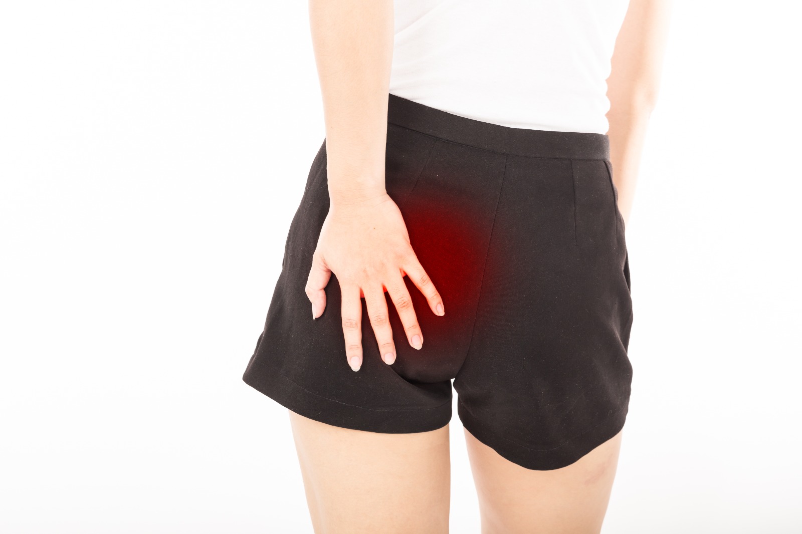 piriformis syndrome